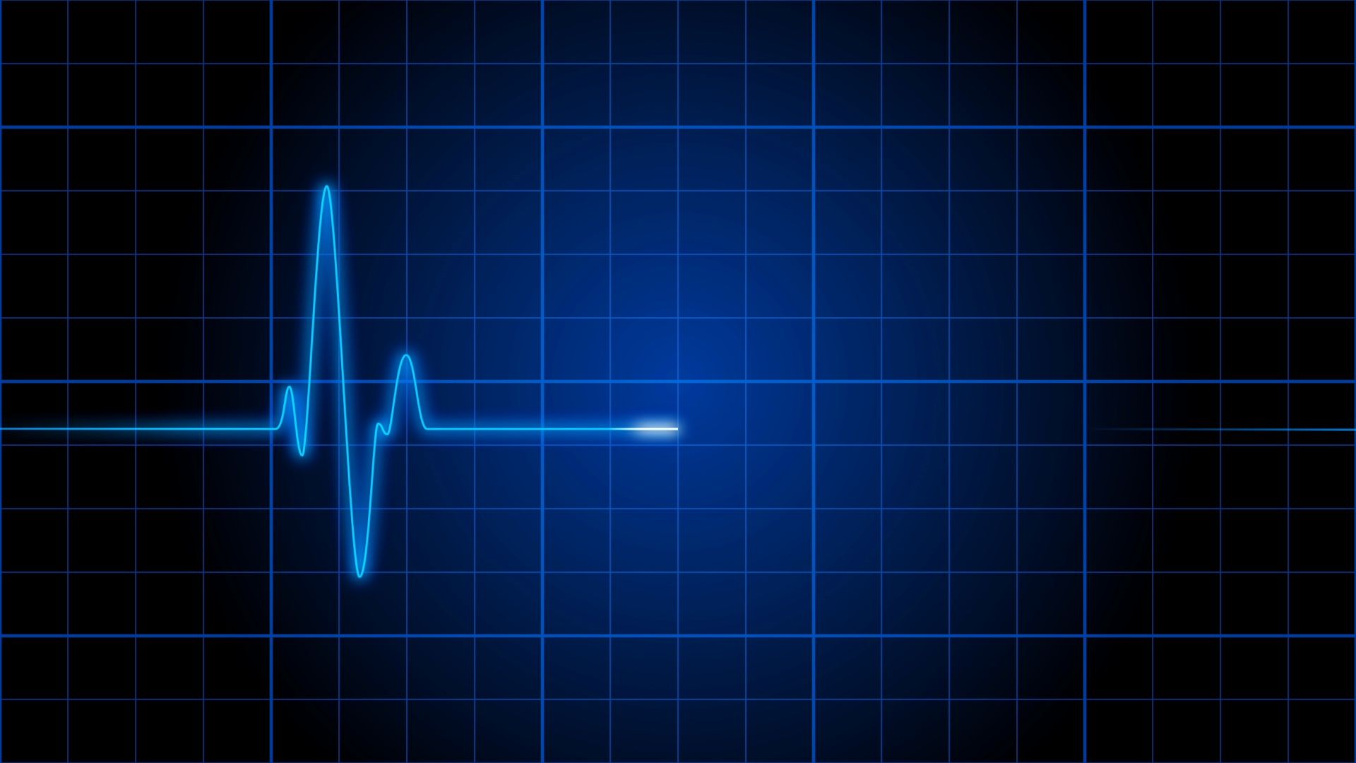 Пульс остановился. Прямая линия на кардиограмме. Остановка сердца на ЭКГ. Прямая линия на ЭКГ. Диаграмма сердцебиения.