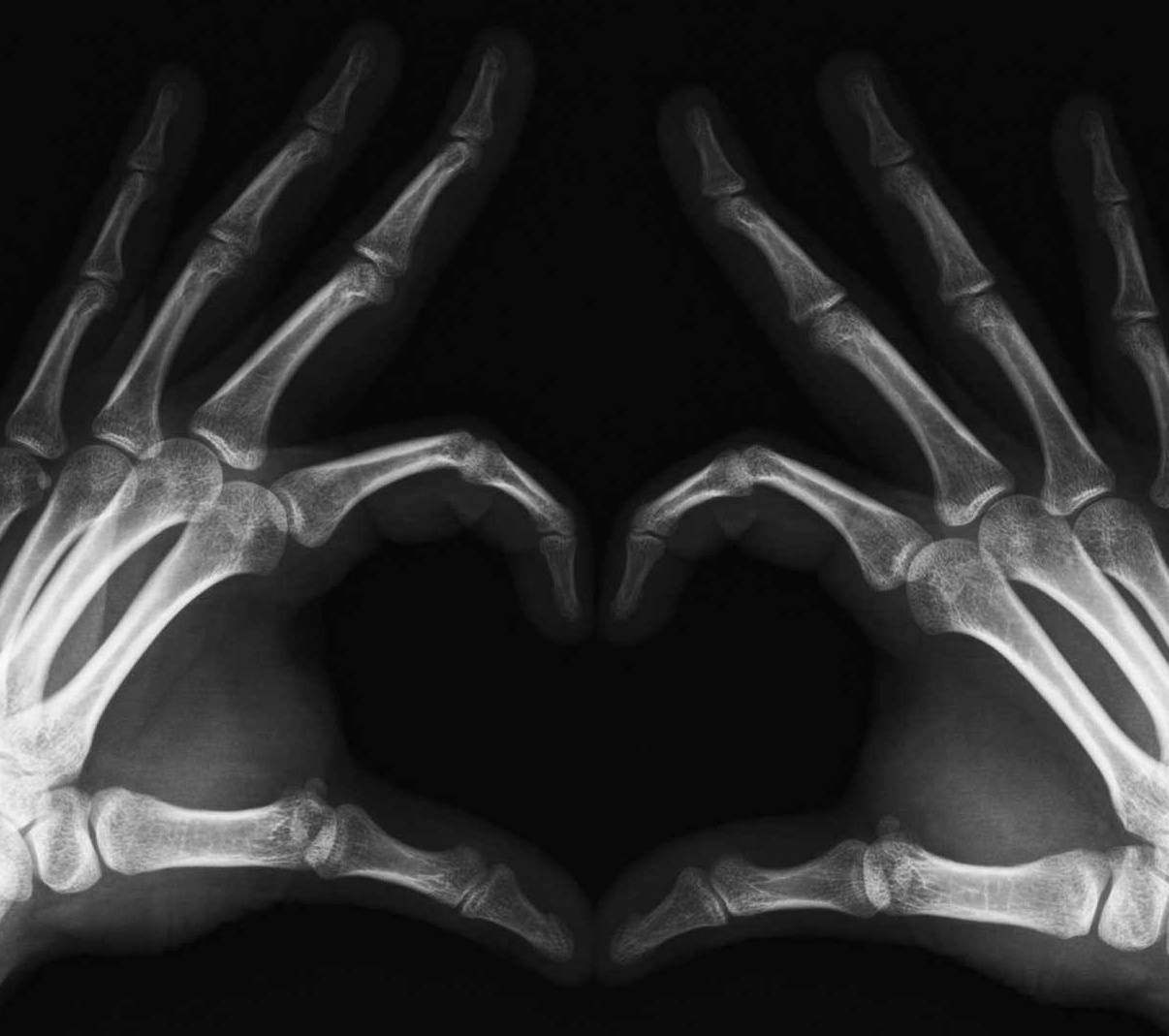 x ray wallpaper,x ray,radiography,medical,organ,medical imaging (#711343) -  WallpaperUse