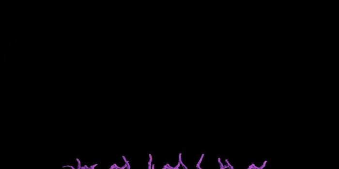 1080x1920 Xxxtentacion 1080 X 1080 Pictures Pin Pinterest Home - Motivational