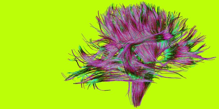 1920x1080 Streets lined with 'leafy trees' boost community's overall health