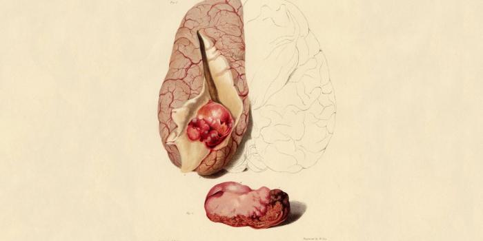 1680x1050 Human Anatomy Wallpaper Desktop - Nutrisi glucolife