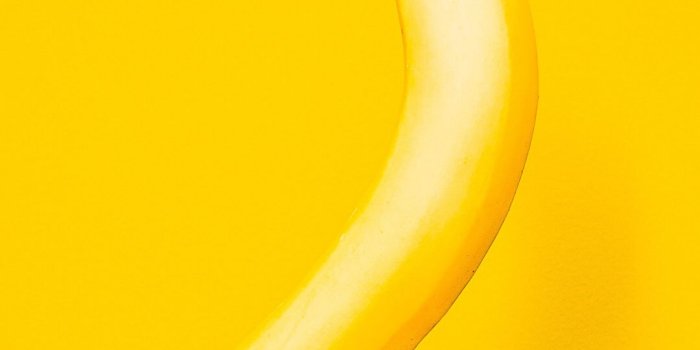 1080x1920 Banana Yellow | Fruits in 2019 | Banana, Iphone wallpaper, Yellow fruit