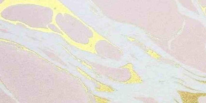 853x1517 Aesthetic Rose Computer Wallpapers - Top Free Aesthetic Rose