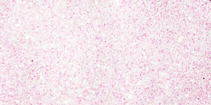 1152x2048 Pretty Glitter Wallpapers