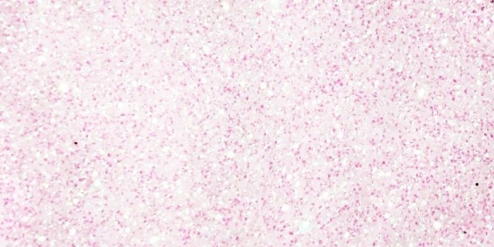 1152x2048 76+ Cute Glitter Wallpapers on WallpaperPlay