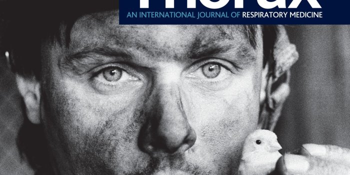 1654x2205 Use of inhaled corticosteroids and the risk of tuberculosis | Thorax