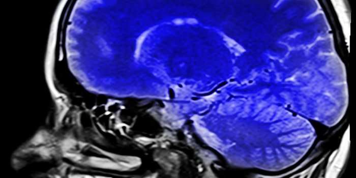 910x910 HD wallpaper: CT scan of human brain, head, magnetic resonance