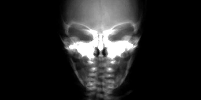 768x1024 Miscellaneous - X-Ray Scan Of Alien Head - iPad iPhone HD