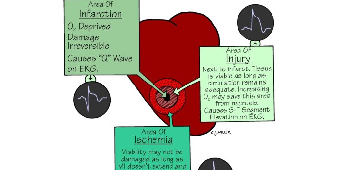 1600x1200 Nursing School: Medical Surgical Nursing Mnemonics