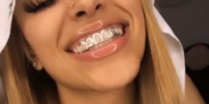 1125x1387 Angel isai on Black Girl Magic ❣️ | Girl grillz, Braces girls, Light  skin girls