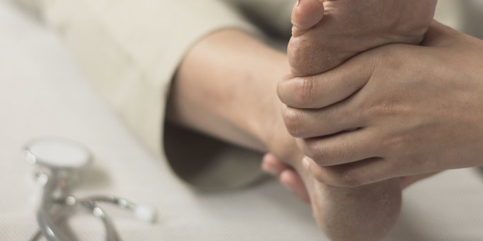 3620x3620 Rheumatoid Arthritis and Foot Deformity