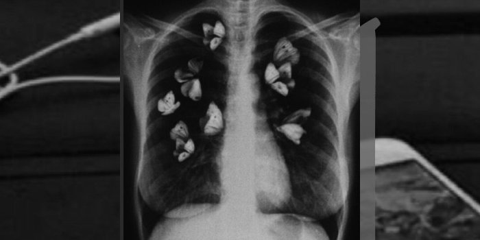 828x1472 grey wallpapers | Grey wallpaper, Black and grey wallpaper, Dark grey  wallpaper