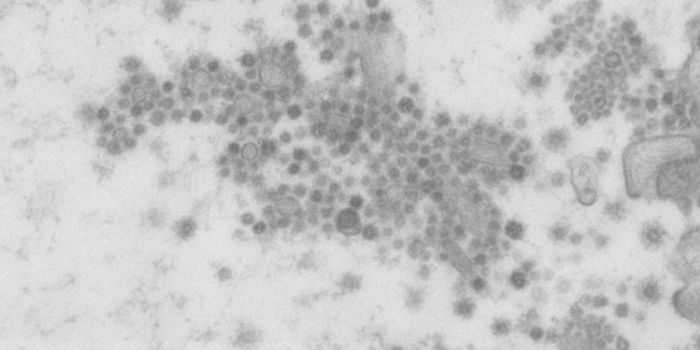 1328x1158 Covid virus images shared for global