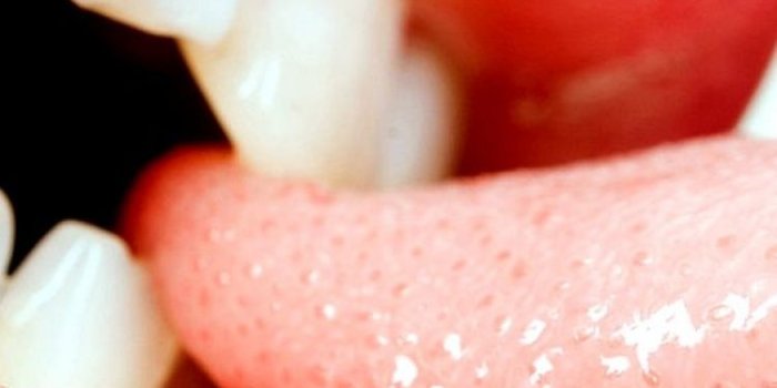 750x1334 Lips Kiss Full HD Quality Pics Lips Kiss Image Widescreen | GG | Lip