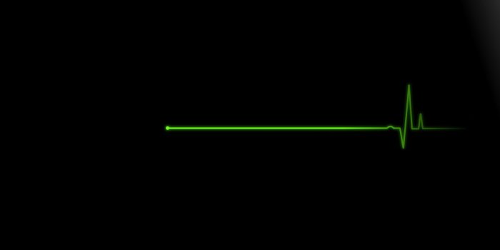 1680x1050 ECG Wallpapers