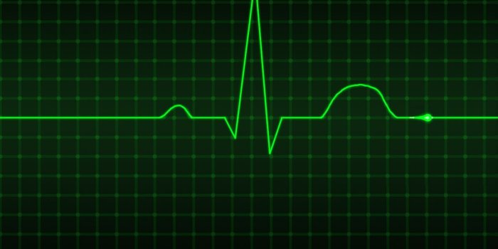 1280x1024 What Exactly Is an Electrocardiogram? An electrocardiogram (EKG or