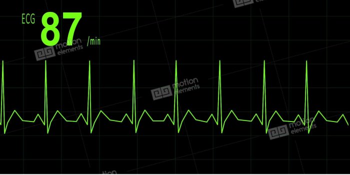 1920x1080 Best 52+ Cardiogram Wallpaper on HipWallpaper | Echocardiogram