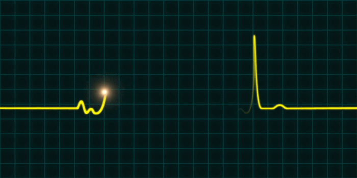 1920x1080 An animated EKG heartbeat monitor in yellow wave line (two beat). Audio is  included. Full HD footage Motion Background - Storyblocks Video