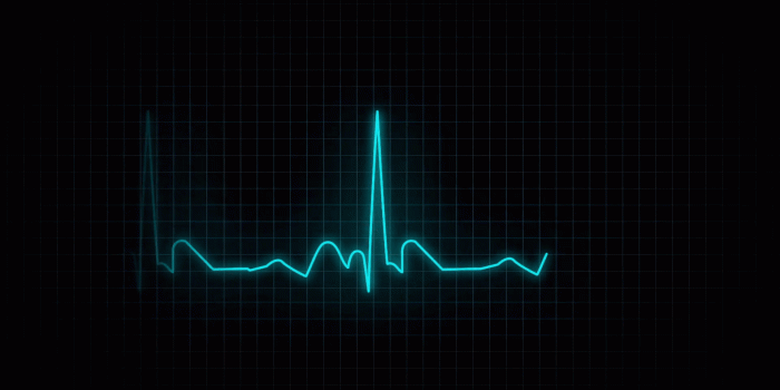 1920x1080 EKG (Heartbeat Monitor - Electrocardiogram) Motion Background - Storyblocks  Video