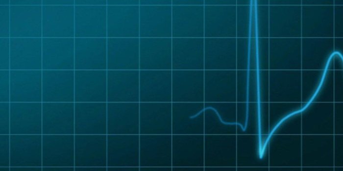 1024x768 Ecg Wallpaper Group (67+), HD Wallpapers