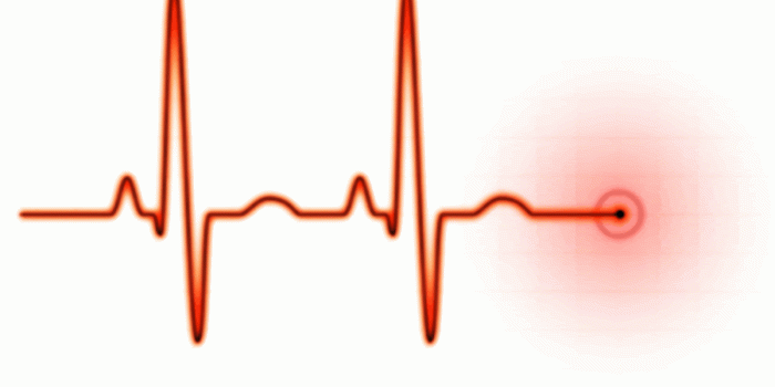 1200x893 CLIPART WALLPAPER BLINK - Pulse Clipart ekg 24 - 1200 X 893 for