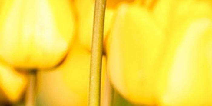 1125x2437 Elegant yellow flowers iPhone X2 Wallpapers Download-iPhoneX2Wallpaper