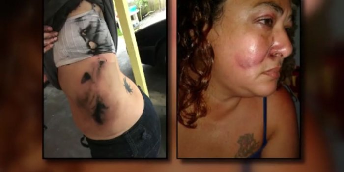 1600x900 A vape pen explosion injures two people in Florida.