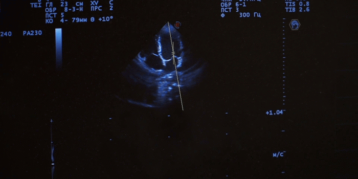 1920x1080 Ultrasound. Cardiology. Monitor screen close up. Examination of heart with  ultrasound. Doctor cardiologist reviewing patient with ultra sound Stock