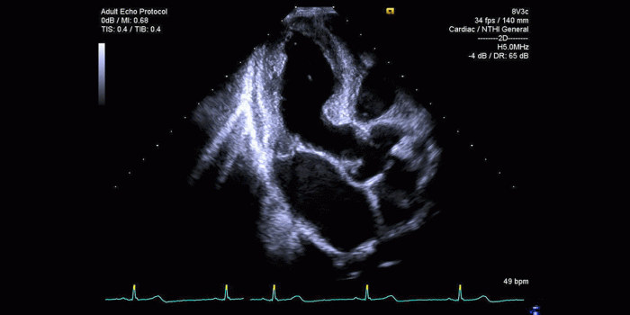1920x1080 Cardiology - Siemens Healthineers Global