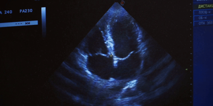 1920x1080 Ultrasound. Cardiology. Monitor screen close up. Examination of heart with  ultrasound. Doctor cardiologist reviewing patient with ultra sound Stock