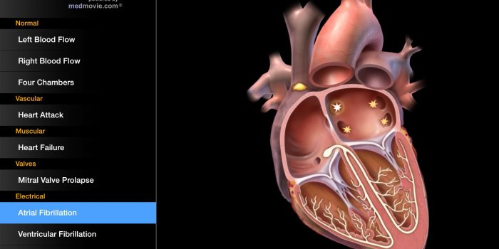 2048x1536 Top 10 Cardiology apps for Cardiologists and Internists