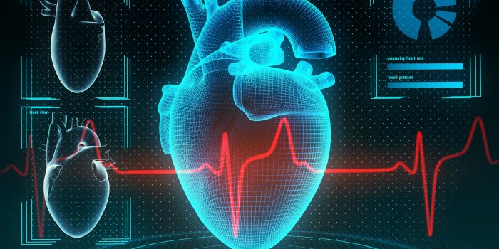 2500x1875 Cardiac MR and AI - Insights GE Healthcare