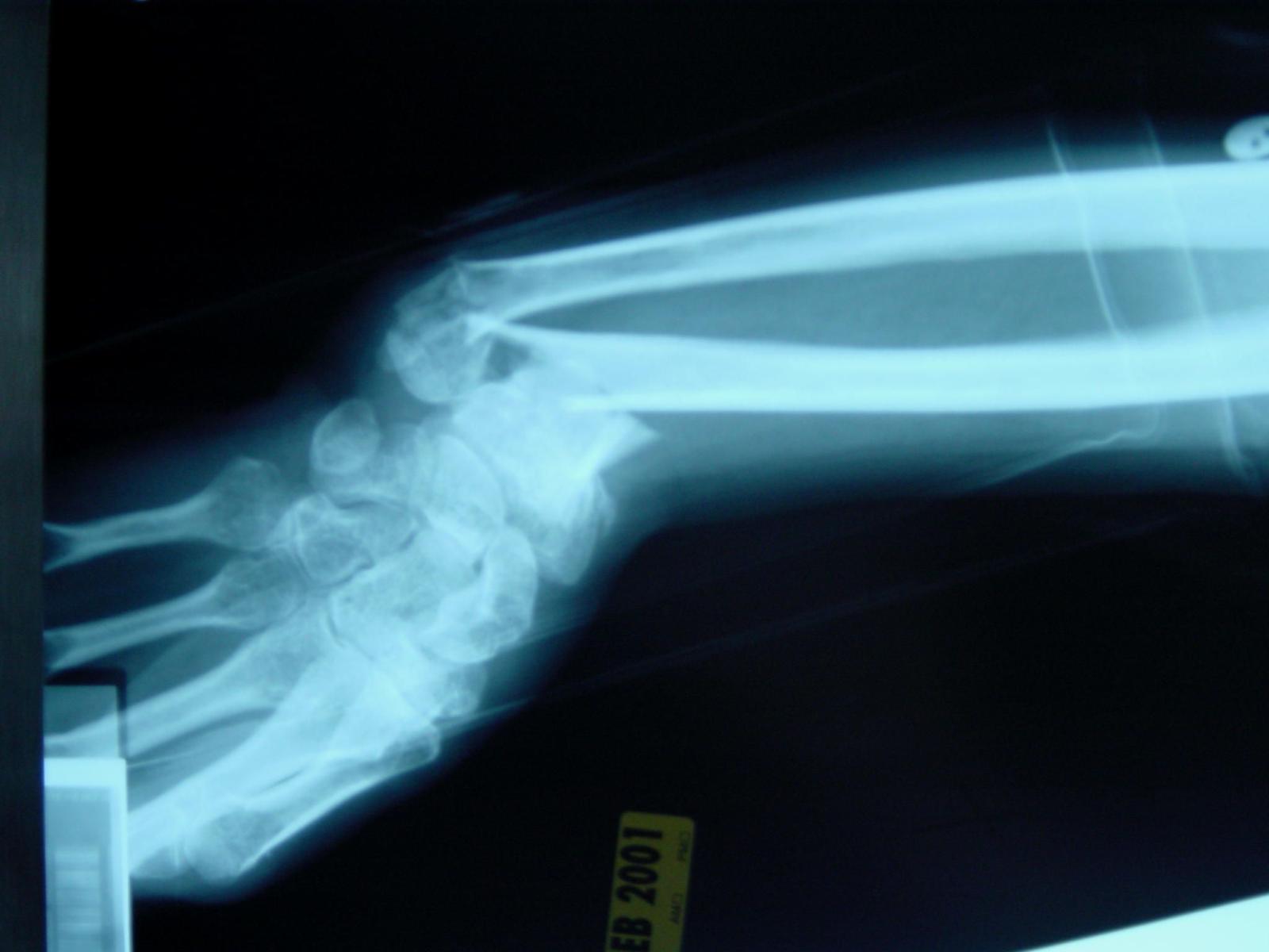 2048x1536 musculoskeletal - Orthopedics Photo (9106942) - Fanpop
