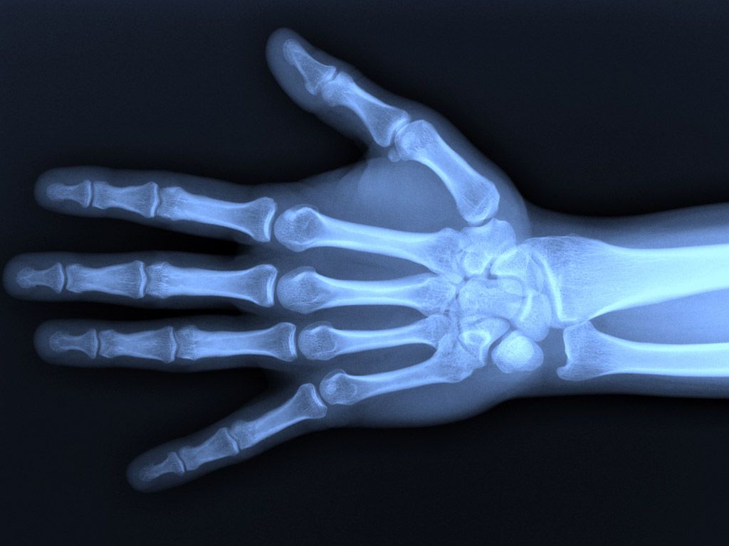 1024x768 Our Orthopedic Surgeries & Services - Orthopaedic Specialty Care