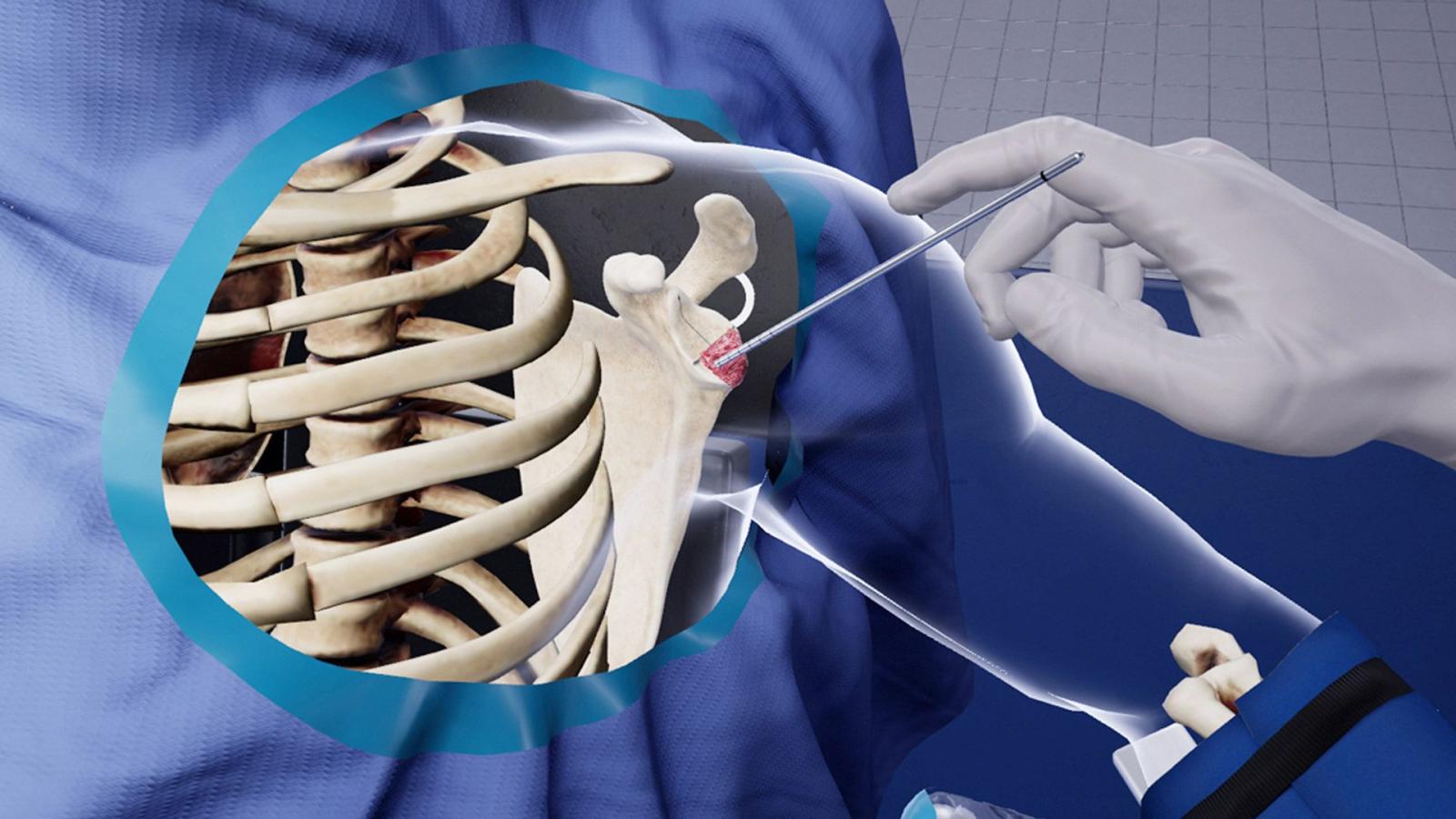 1920x1080 Precision OS Secures $2.3M Series A to Further VR Orthopedic