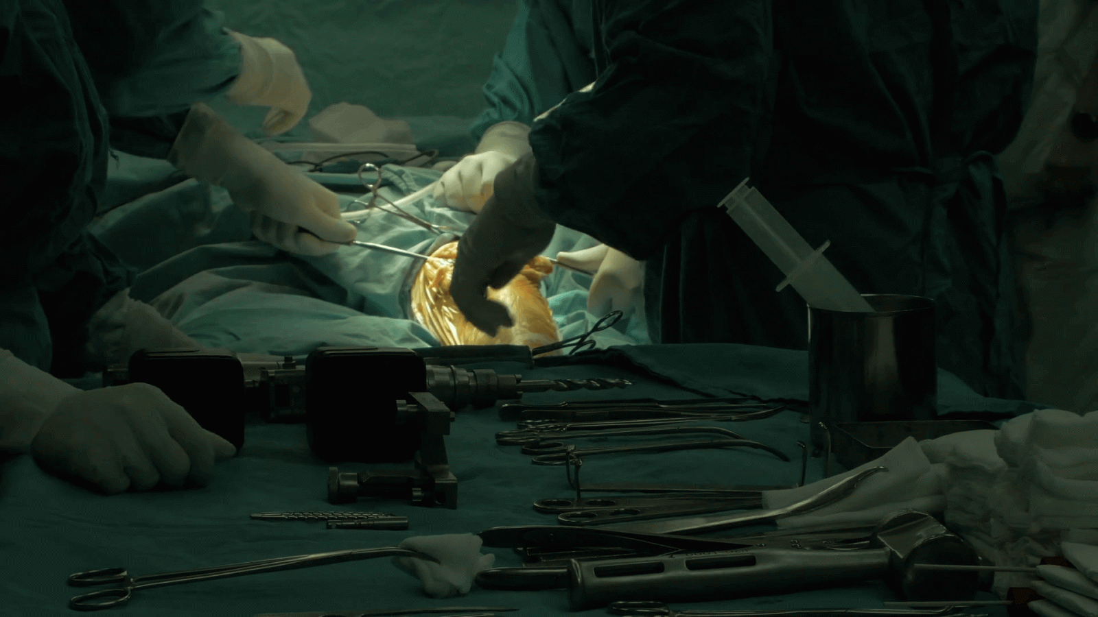 1920x1080 Heavy orthopedic surgical equipment on tray table close up, nurse hands  adding tools team of surgeons in protective gloves using instruments to