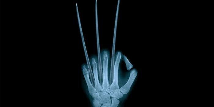 3840x2160 69+ X Ray Wallpapers on WallpaperPlay