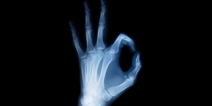 1920x1200 12 X-ray HD Wallpapers | Background Images