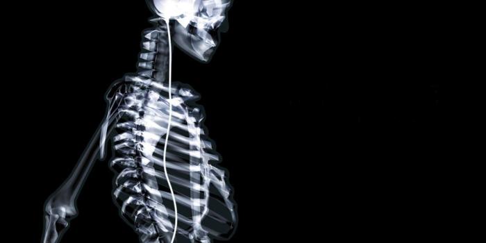 1600x1200 x ray wallpaper