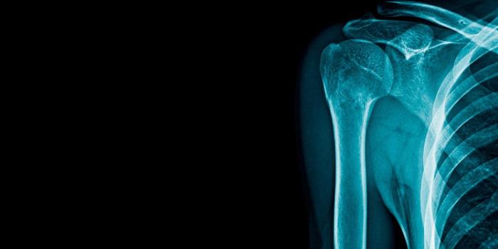 1332x850 Wallpaper blue, bones, x-ray images for desktop, section минимализм