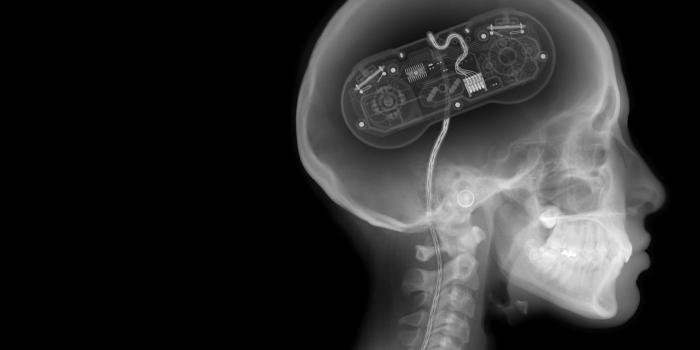 2688x1680 69+ X Ray Wallpapers on WallpaperPlay