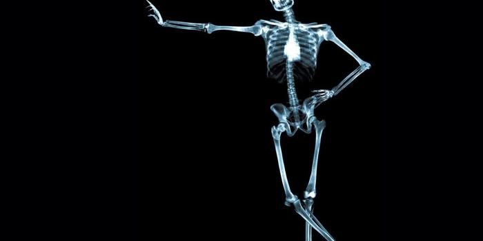 1280x960 44+] X Ray Wallpapers on WallpaperSafari