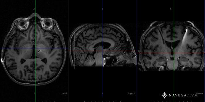 1920x1080 Navegatium | NVKB - Navegatium Knowlegde Base