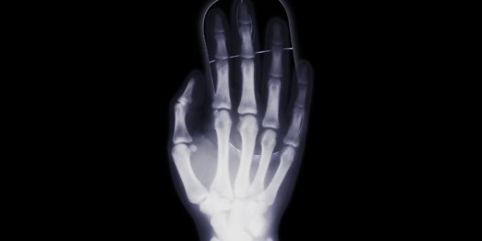 3840x2400 Download wallpaper 3840x2400 arm, x-ray, bone, computer mouse 4k