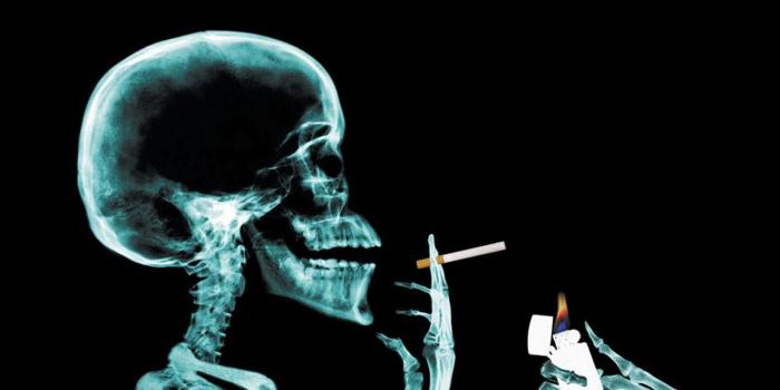 1280x960 X-ray Wallpapers