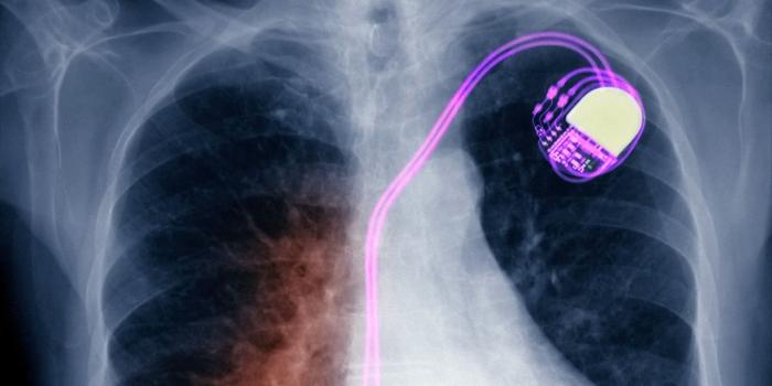 1280x1024 X Ray Wallpaper (44+ images) on Genchi.info