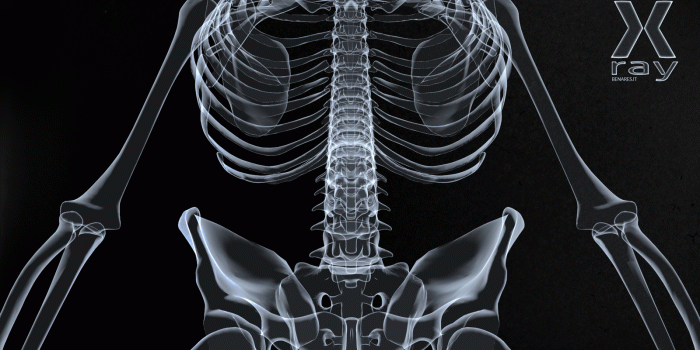 1600x900 Xray wallpaper Gallery