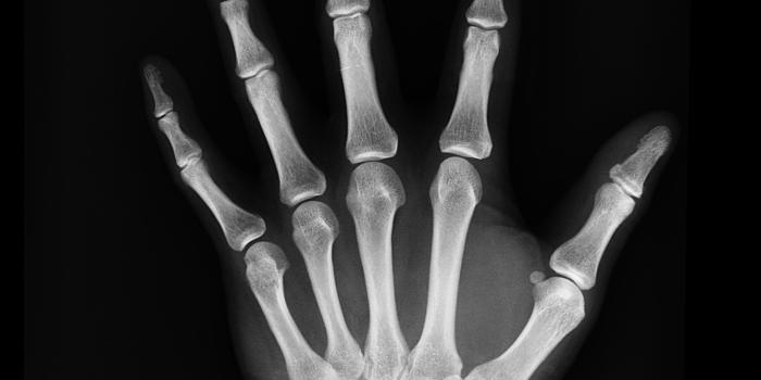 5967x7175 Black-and-white, Bones, Hand - Free Stock Photo, Image, Wallpaper
