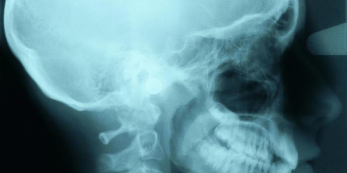 1600x900 Medical Imaging | Agnesian HealthCare