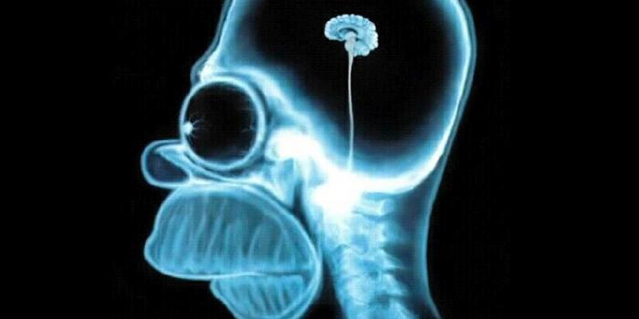 1600x1200 Homer X Ray | WallpaperFool